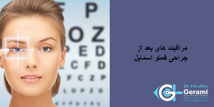 مراقبت‌ های بعد از فمتو اسمایل