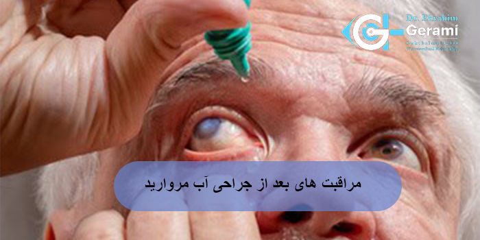 مراقبت های بعد از جراحی آب مروارید