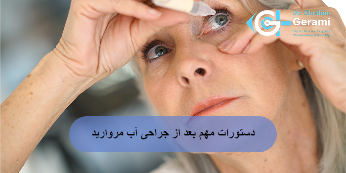 دستورات مهم بعد از جراحی آب مروارید
